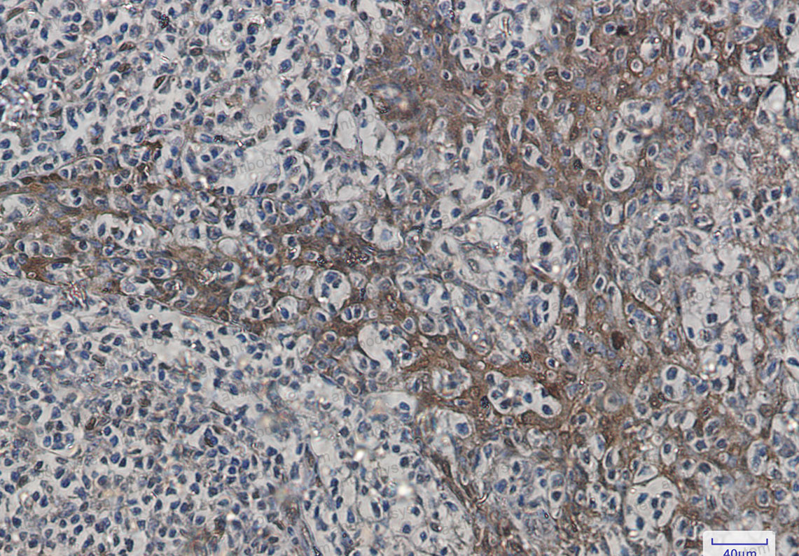 Валидация AntibodySystem RMC69401