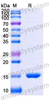 Валидация SDS-PAGE - AntibodySystem RHJ48501