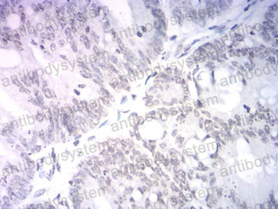 Валидация AntibodySystem RHG58701