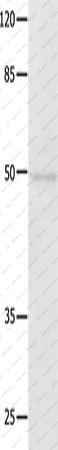 Вестерн-блоттинг, NAP1L1, клетки Jurkat