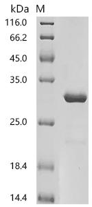 SDS-PAGE