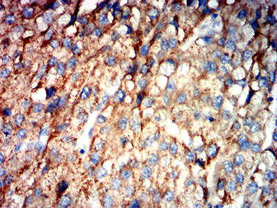 Валидация AntibodySystem RHJ90504