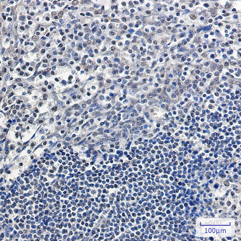 Валидация AntibodySystem RHD74801