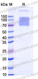 AHB65402, SDS-PAGE