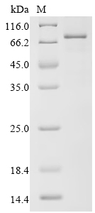 SDS-PAGE