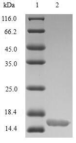 SDS-PAGE
