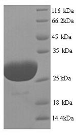 SDS-PAGE