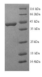 SDS-PAGE