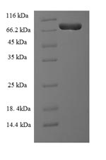 SDS-PAGE
