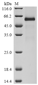 SDS-PAGE