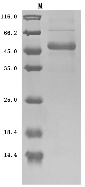 SDS-PAGE