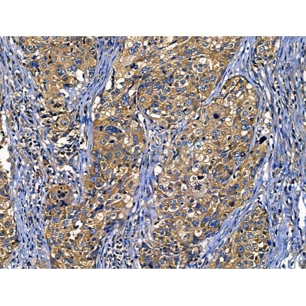 Валидация Affinity AF5155 - 2555