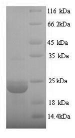 SDS-PAGE