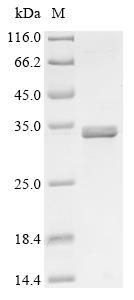 SDS-PAGE