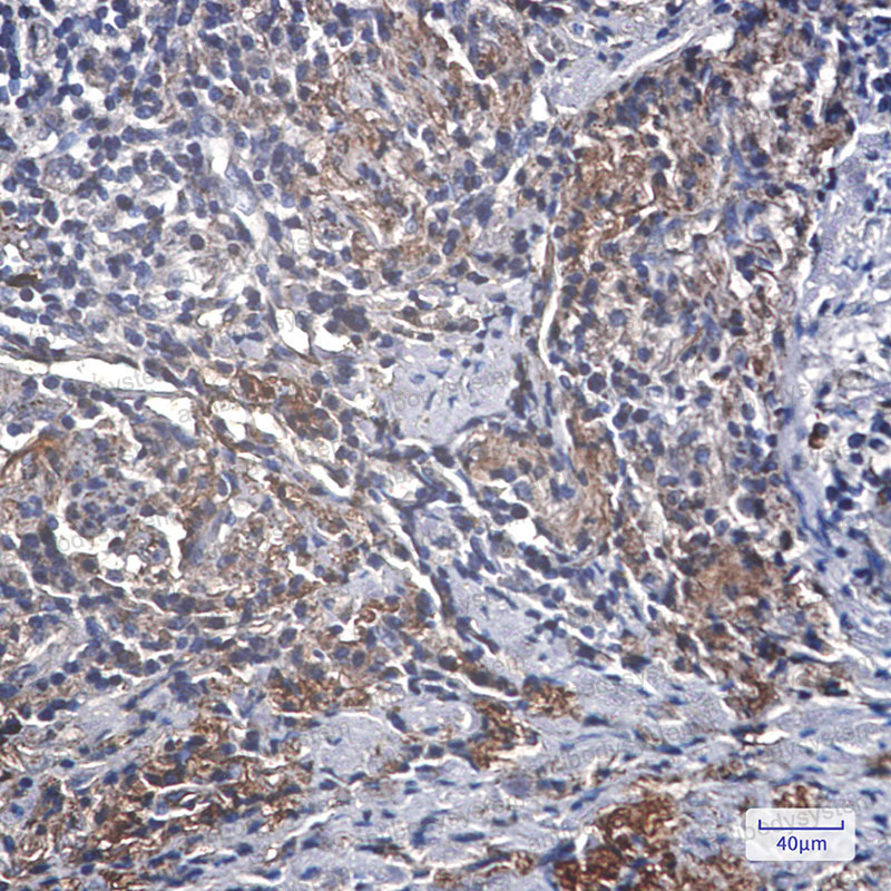 Валидация AntibodySystem RHH25202