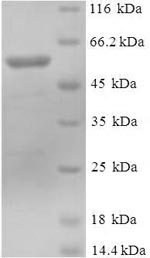 SDS-PAGE