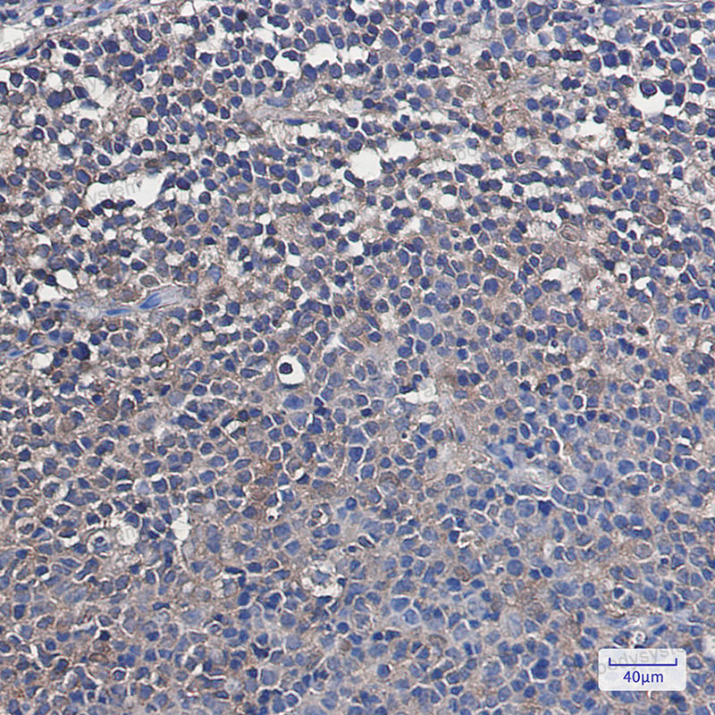 Валидация AntibodySystem RHF08801