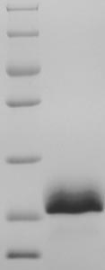 SDS-PAGE