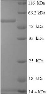SDS-PAGE