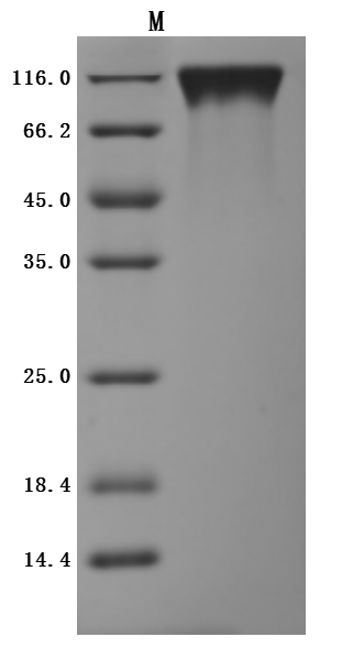 SDS-PAGE