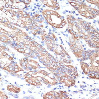 Иммуногистохимия, CytokeRatin-18, ткань тонкой кишки человека