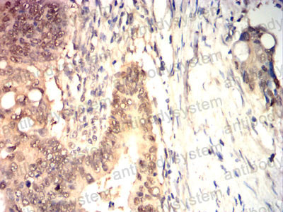 Валидация AntibodySystem RHE05803