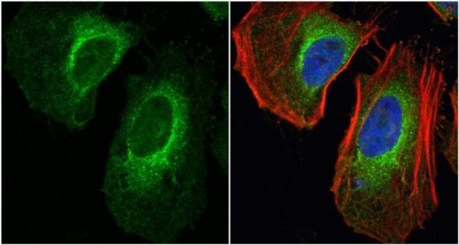 Валидация AssayVector ARM1390(1098)