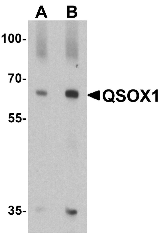 Валидация AssayVector ARM2489(4451)