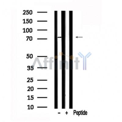 Валидация Affinity AF7574 - 4238