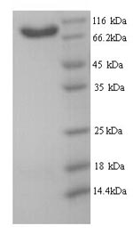 SDS-PAGE