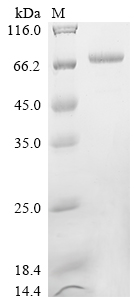 SDS-PAGE
