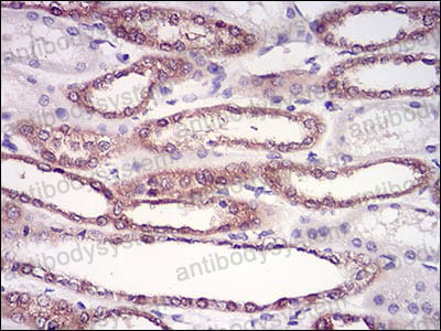 Валидация AntibodySystem RHB86602