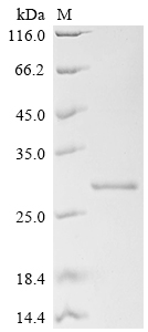 SDS-PAGE