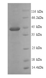 SDS-PAGE