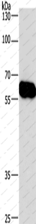 Вестерн-блоттинг, CORO1C, клетки Lovo