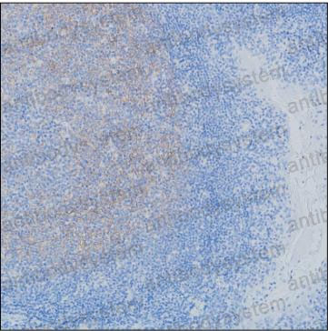 Валидация AntibodySystem RHD27006