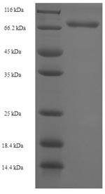 SDS-PAGE