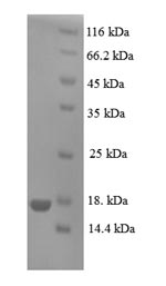SDS-PAGE