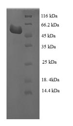 SDS-PAGE
