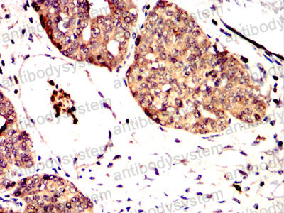 Валидация AntibodySystem RHN88903 (3918)