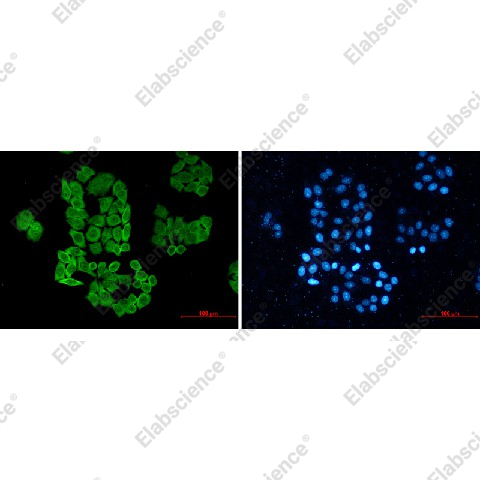 Иммунофлуоресценция, CCT2, клетки HeLa