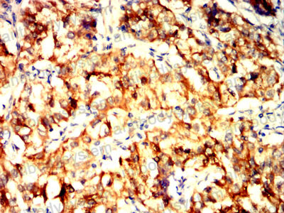 Валидация AntibodySystem RHD23003 (1410)