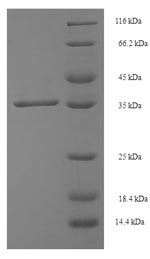 SDS-PAGE