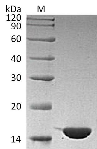 SDS-PAGE