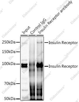 Иммунопреципитация и вестерн-блоттинг, Insulin Receptor, клетки HeLa