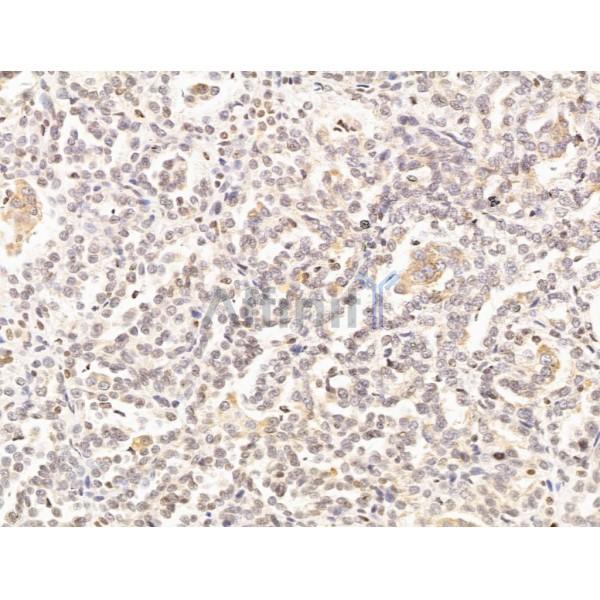 Валидация Affinity DF13607 - 9108