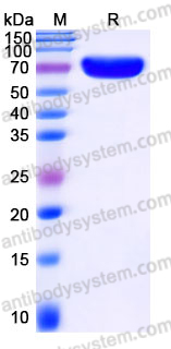 AHJ32504, SDS-PAGE