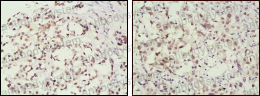 Валидация AntibodySystem RHE40503