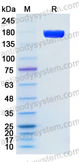 AHD27401, SDS-PAGE