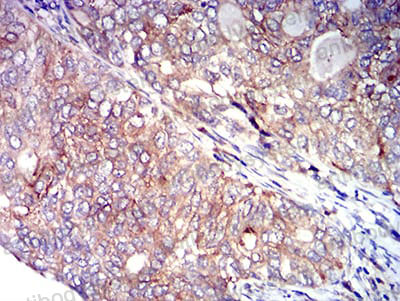 Валидация AntibodySystem RHE43202